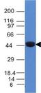 Keratin 8 antibody, GTX34666, GeneTex, Western Blot image 