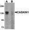 CASK Interacting Protein 1 antibody, TA319979, Origene, Western Blot image 