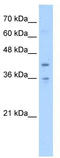 Transmembrane Protein 104 antibody, TA342034, Origene, Western Blot image 