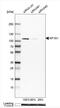 Adaptor Related Protein Complex 1 Subunit Gamma 1 antibody, NBP2-58947, Novus Biologicals, Western Blot image 