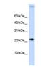 Chromatin Accessibility Complex Subunit 1 antibody, NBP1-80334, Novus Biologicals, Western Blot image 