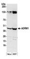 Adhesion Regulating Molecule 1 antibody, NBP1-30447, Novus Biologicals, Western Blot image 