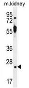 Tetratricopeptide Repeat Domain 9B antibody, AP54403PU-N, Origene, Western Blot image 