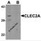 C-Type Lectin Domain Family 2 Member A antibody, 6959, ProSci, Western Blot image 