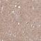 Talin 2 antibody, NBP2-62621, Novus Biologicals, Immunohistochemistry paraffin image 