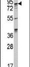 AP2 Associated Kinase 1 antibody, PA5-15023, Invitrogen Antibodies, Western Blot image 