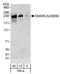 SWI/SNF Related, Matrix Associated, Actin Dependent Regulator Of Chromatin, Subfamily A, Member 2 antibody, A301-016A, Bethyl Labs, Western Blot image 