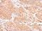 Zinc Finger Protein 134 antibody, PA5-27800, Invitrogen Antibodies, Immunohistochemistry paraffin image 