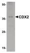 Caudal Type Homeobox 2 antibody, PA5-20891, Invitrogen Antibodies, Western Blot image 