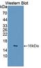 General Transcription Factor IIA Subunit 2 antibody, LS-C663460, Lifespan Biosciences, Western Blot image 