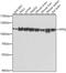 Splicing Factor Proline And Glutamine Rich antibody, A02243, Boster Biological Technology, Western Blot image 
