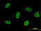 Ribosomal L24 Domain Containing 1 antibody, LS-B6227, Lifespan Biosciences, Immunofluorescence image 