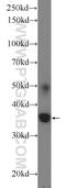 All-Trans Retinoic Acid Induced Differentiation Factor antibody, 25548-1-AP, Proteintech Group, Western Blot image 