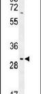 Transmembrane Protein 65 antibody, PA5-23864, Invitrogen Antibodies, Western Blot image 