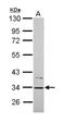 Cytochrome B5 Reductase 1 antibody, NBP2-16047, Novus Biologicals, Western Blot image 