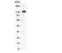 Integrin Subunit Alpha 3 antibody, R30703, NSJ Bioreagents, Western Blot image 