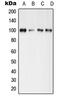 Glutamate Ionotropic Receptor AMPA Type Subunit 4 antibody, MBS822009, MyBioSource, Western Blot image 