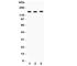 Reticulon 3 antibody, R31380, NSJ Bioreagents, Western Blot image 