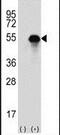 Carbonic Anhydrase 14 antibody, PA5-14190, Invitrogen Antibodies, Western Blot image 