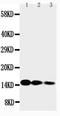 Interleukin 3 antibody, LS-C312589, Lifespan Biosciences, Western Blot image 