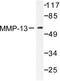 Matrix Metallopeptidase 13 antibody, LS-C176122, Lifespan Biosciences, Western Blot image 