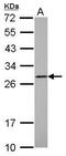 Catechol-O-Methyltransferase antibody, PA5-29901, Invitrogen Antibodies, Western Blot image 