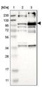 Leucine Rich Repeats And Calponin Homology Domain Containing 2 antibody, NBP1-93588, Novus Biologicals, Western Blot image 