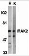 Interleukin-1 receptor-associated kinase-like 2 antibody, 2123, ProSci, Western Blot image 