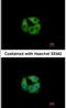 Propionyl-CoA Carboxylase Subunit Beta antibody, NBP1-31464, Novus Biologicals, Immunocytochemistry image 