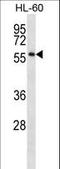 One Cut Homeobox 1 antibody, LS-C163122, Lifespan Biosciences, Western Blot image 