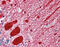 Alpha-Methylacyl-CoA Racemase antibody, 49-063, ProSci, Immunohistochemistry paraffin image 