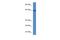 Acyl-CoA Synthetase Short Chain Family Member 2 antibody, A02809, Boster Biological Technology, Western Blot image 