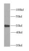 Myotilin antibody, FNab05521, FineTest, Western Blot image 