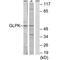 Glycerol Kinase antibody, PA5-49801, Invitrogen Antibodies, Western Blot image 