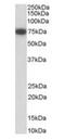 Nerve Growth Factor Receptor antibody, orb19018, Biorbyt, Western Blot image 