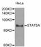 Signal Transducer And Activator Of Transcription 5A antibody, STJ110044, St John