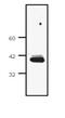Stearoyl-CoA Desaturase antibody, GTX19862, GeneTex, Western Blot image 