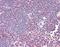 Zeta Chain Of T Cell Receptor Associated Protein Kinase 70 antibody, M00754, Boster Biological Technology, Immunohistochemistry frozen image 