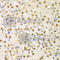 Stratifin antibody, A1026, ABclonal Technology, Immunohistochemistry paraffin image 