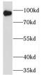 Two Pore Segment Channel 1 antibody, FNab08882, FineTest, Western Blot image 