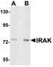 Interleukin 1 Receptor Associated Kinase 1 antibody, orb75886, Biorbyt, Western Blot image 