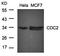 Cyclin Dependent Kinase 1 antibody, orb14623, Biorbyt, Western Blot image 