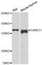 Caspase Recruitment Domain Family Member 11 antibody, LS-C346250, Lifespan Biosciences, Western Blot image 