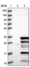 Aurora Kinase A Interacting Protein 1 antibody, PA5-56869, Invitrogen Antibodies, Western Blot image 