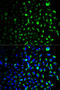 Hexokinase 1 antibody, STJ24019, St John