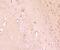 Interferon alpha-1 antibody, NBP2-75930, Novus Biologicals, Immunohistochemistry paraffin image 