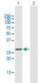 Aurora Kinase A Interacting Protein 1 antibody, H00054998-B01P, Novus Biologicals, Western Blot image 