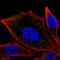 Catalase antibody, HPA055838, Atlas Antibodies, Immunofluorescence image 