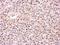 Proteasome 26S Subunit, ATPase 6 antibody, NBP1-32403, Novus Biologicals, Immunohistochemistry paraffin image 