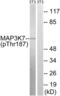 Mitogen-Activated Protein Kinase Kinase Kinase 7 antibody, abx012607, Abbexa, Western Blot image 